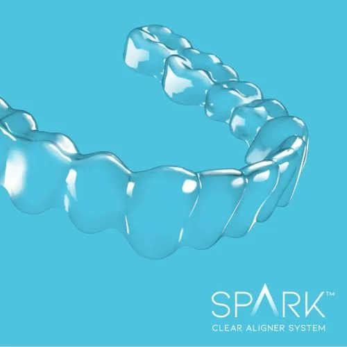 A single Spark clear aligner tray