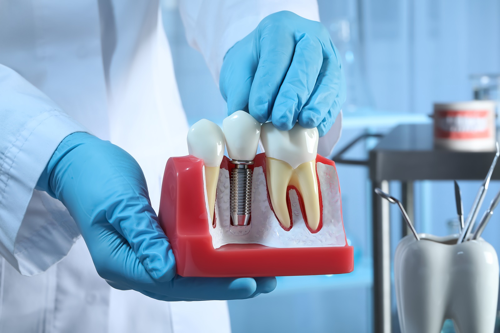 Dental Implants in Yuma, AZ