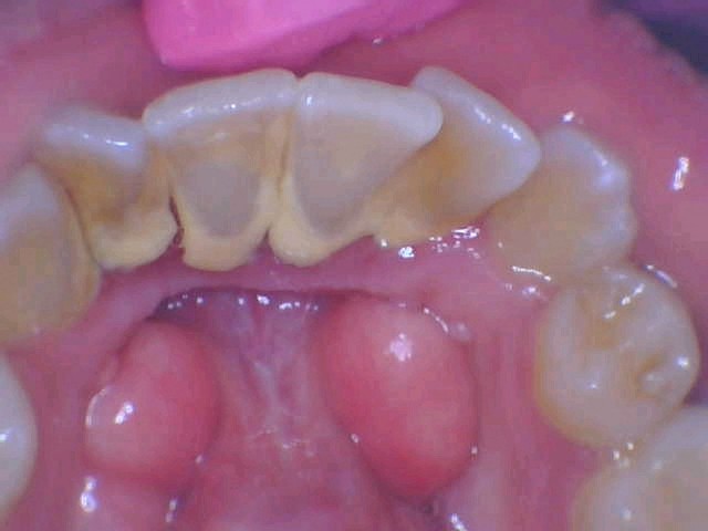 Picacho Family Dental Implant Center of Yuma Picacho Family Dental Implant Center of Yuma