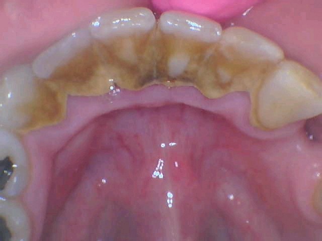 Picacho Family Dental Implant Center of Yuma Picacho Family Dental Implant Center of Yuma